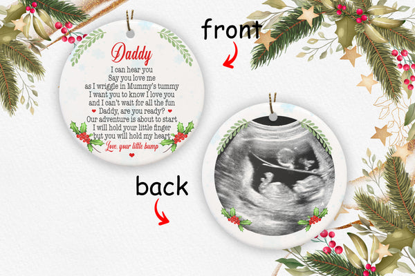 Personalized Ultrasound Ornament| Pregnant Christmas Ornament Ultrasound Bumps First Christmas OP44