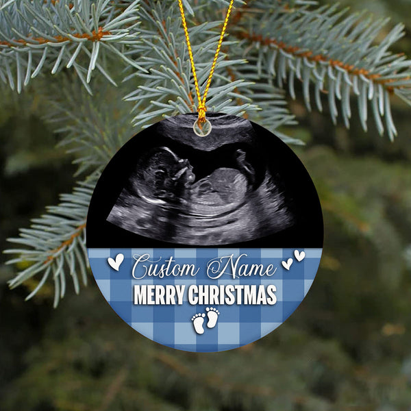 Ornament Baby Ultrasound Photo Pregnancy Announcement Gift Baby Sonogram Ornament on Christmas OP45