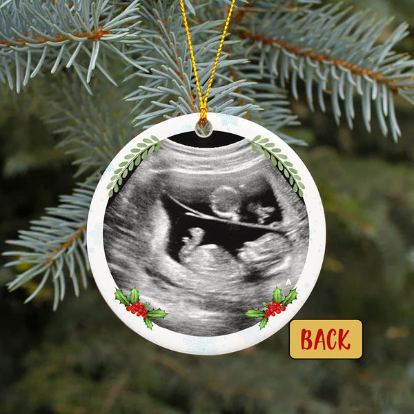 Personalized Ultrasound Ornament| Pregnant Christmas Ornament Ultrasound Bumps First Christmas OP44